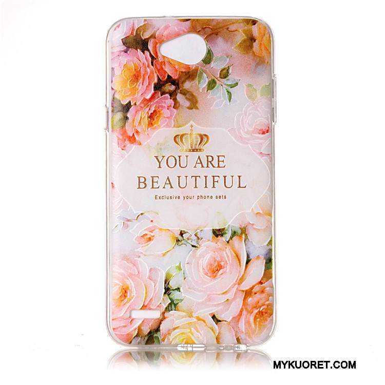 Kuori Lg X Power 2 Pehmeä Neste Puhelimen Kuoret Uusi, Kotelo Lg X Power 2 Luova