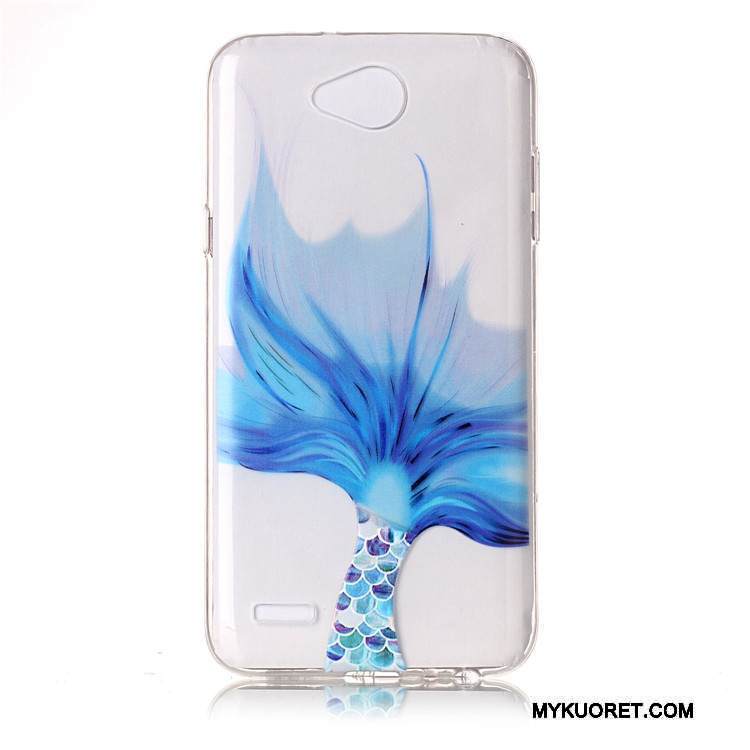 Kuori Lg X Power 2 Pehmeä Neste Puhelimen Kuoret Uusi, Kotelo Lg X Power 2 Luova